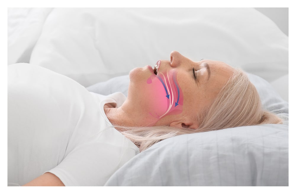 jefferson sleep apnea treatment ETX Dental, East Texas Dental, Dr. Travis Horn, DDS, Dental Implants, Wisdom Teeth Extractions, Root Canal Therapy, Sedation Dentistry, Cosmetic Dentistry, Restorative Dentistry, Sleep Apnea Treatment, Emergency Dental Services, Dentures, Dental cleanings, dental exams, family dentistry, general dentistry, children's dentistry, dental sealants, fluoride treatment, gum disease treatment therapy, periodontal maintenance, porcelain dental veneers, Dental crowns, dental bridges, dental bonding, teeth whitening, smile makeover, clear aligners, traditional metal braces, orthodontics in Jefferson, Dentist in Jefferson TX, Full Mouth Rehabilitation, Emergency Dentistry, New Patients: (903) 664-8448, Current Patients 903-665-3914, 601 N Walnut St, Jefferson, TX 75657