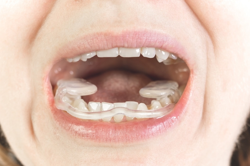 TMJ Treatment Jefferson